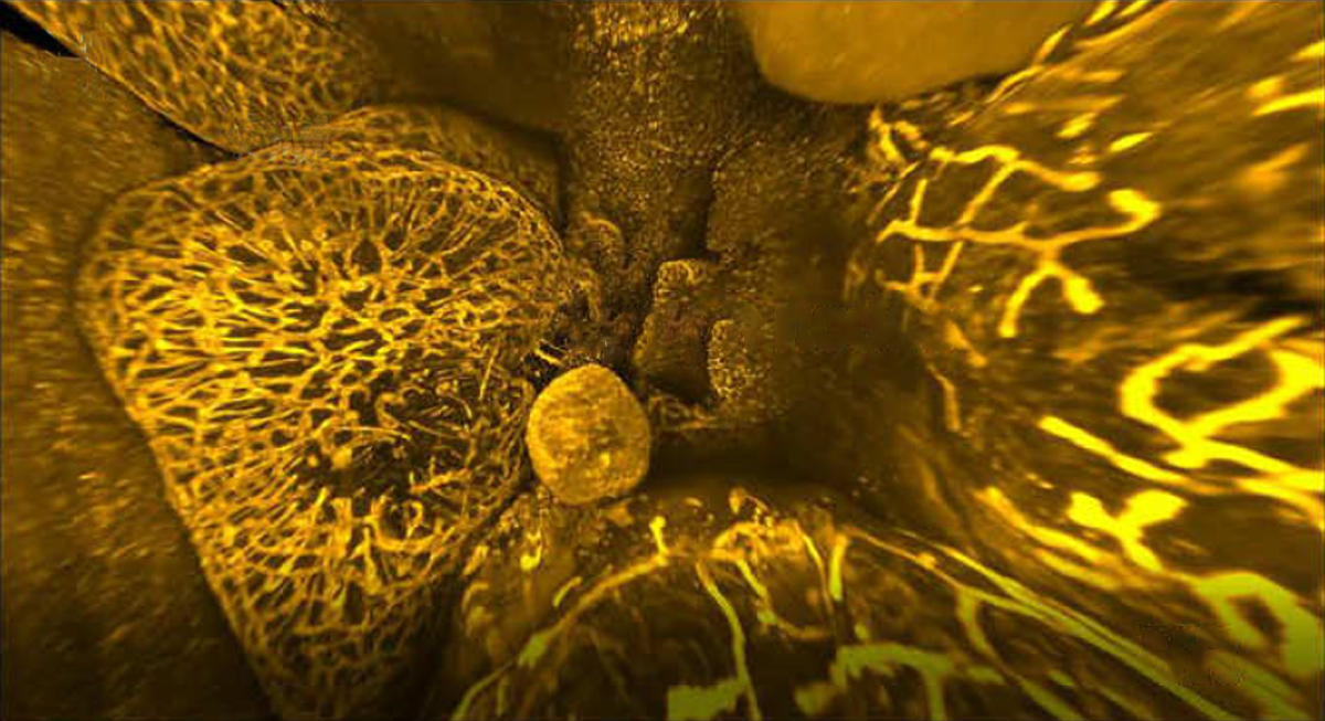Research image of the lymphatic network visualized in the gut of a transparent mouse.