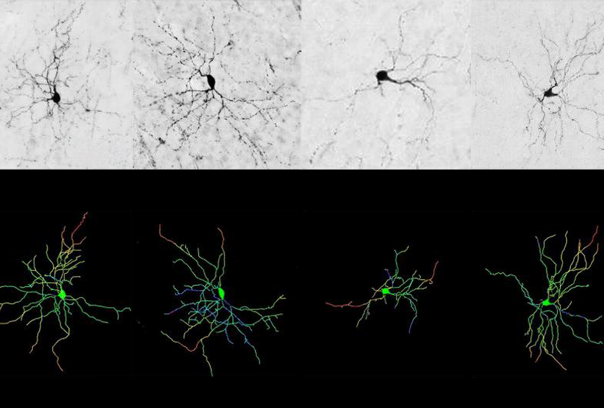 Research image of neurons.