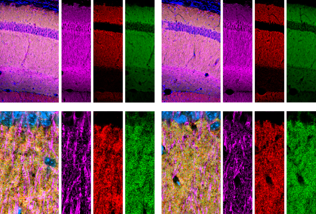 Image of excitatory synapses in mouse brains.