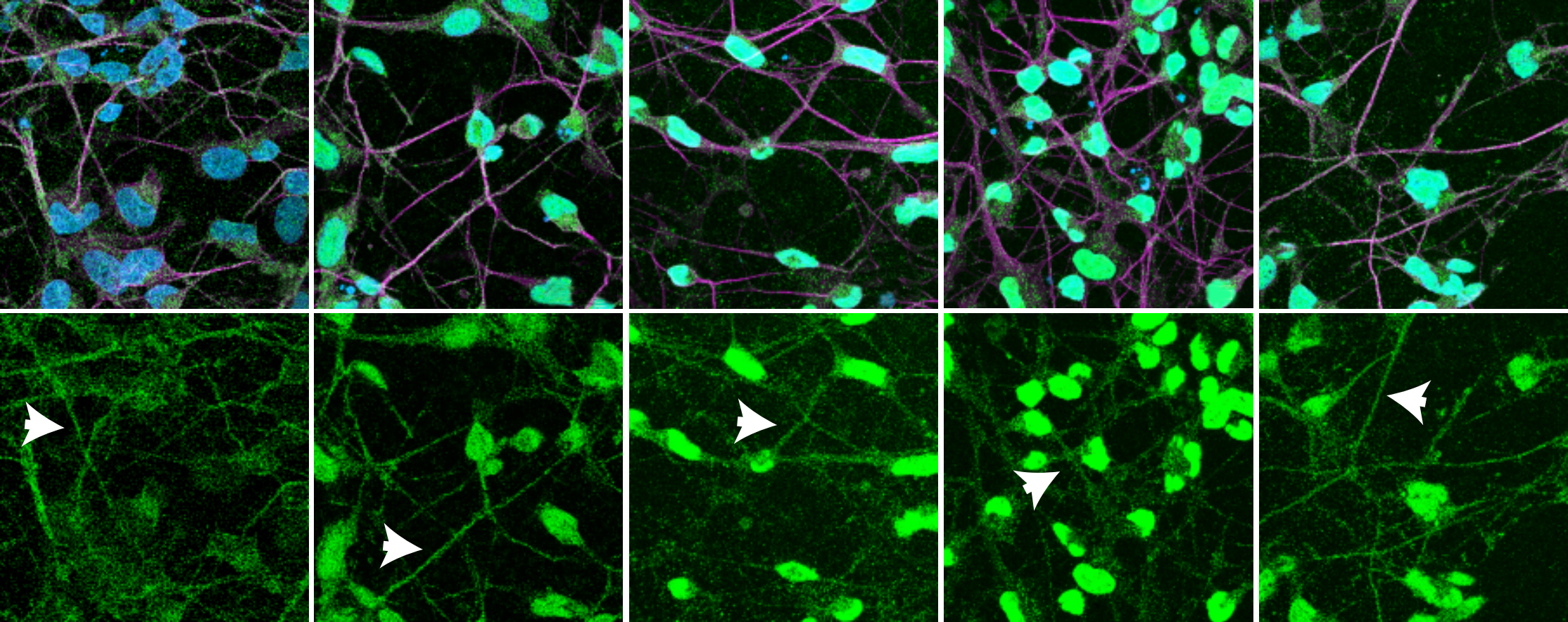 10 side-by-side images of human cortical neurons