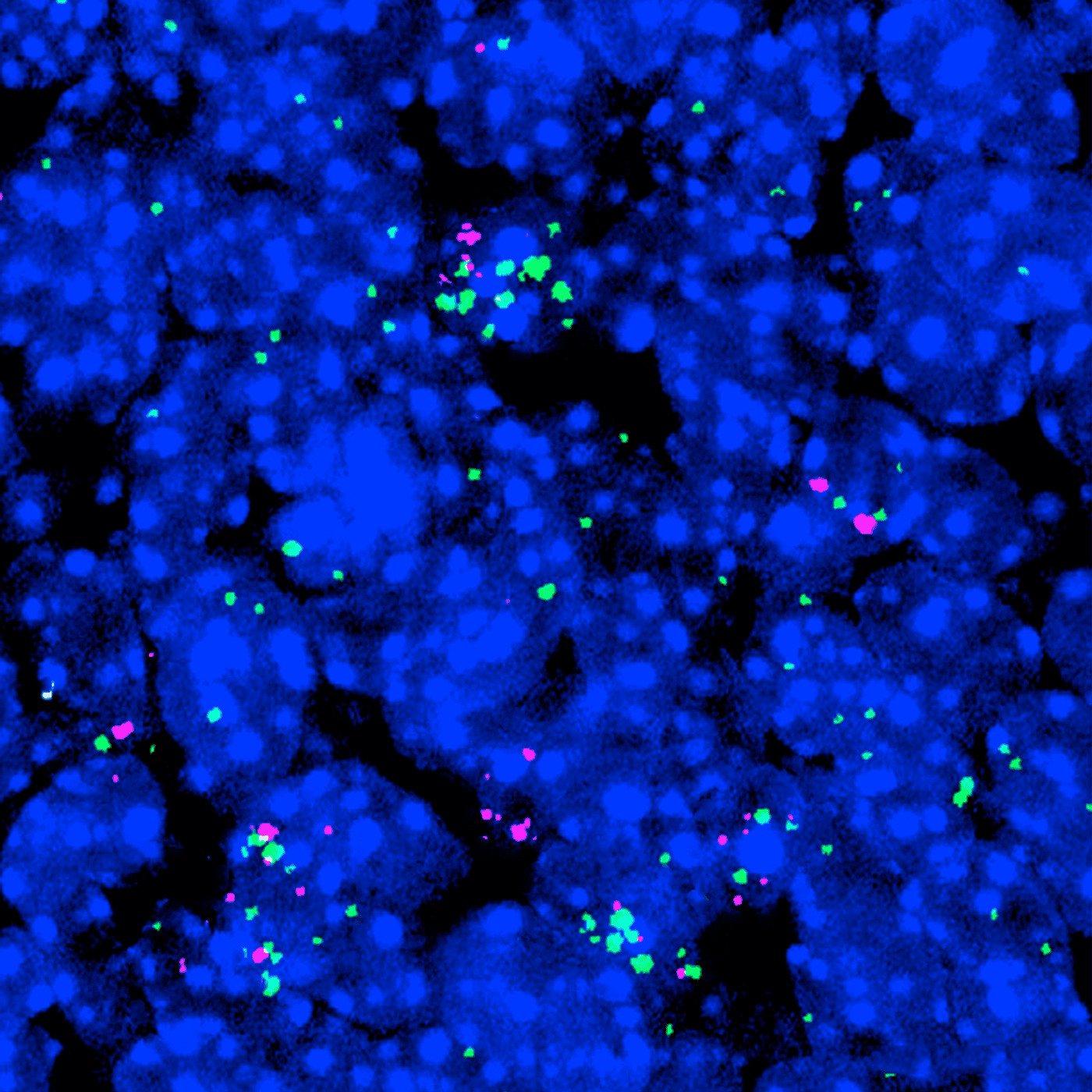 'Gain-of-function' mutation spawns autism traits episode artwork