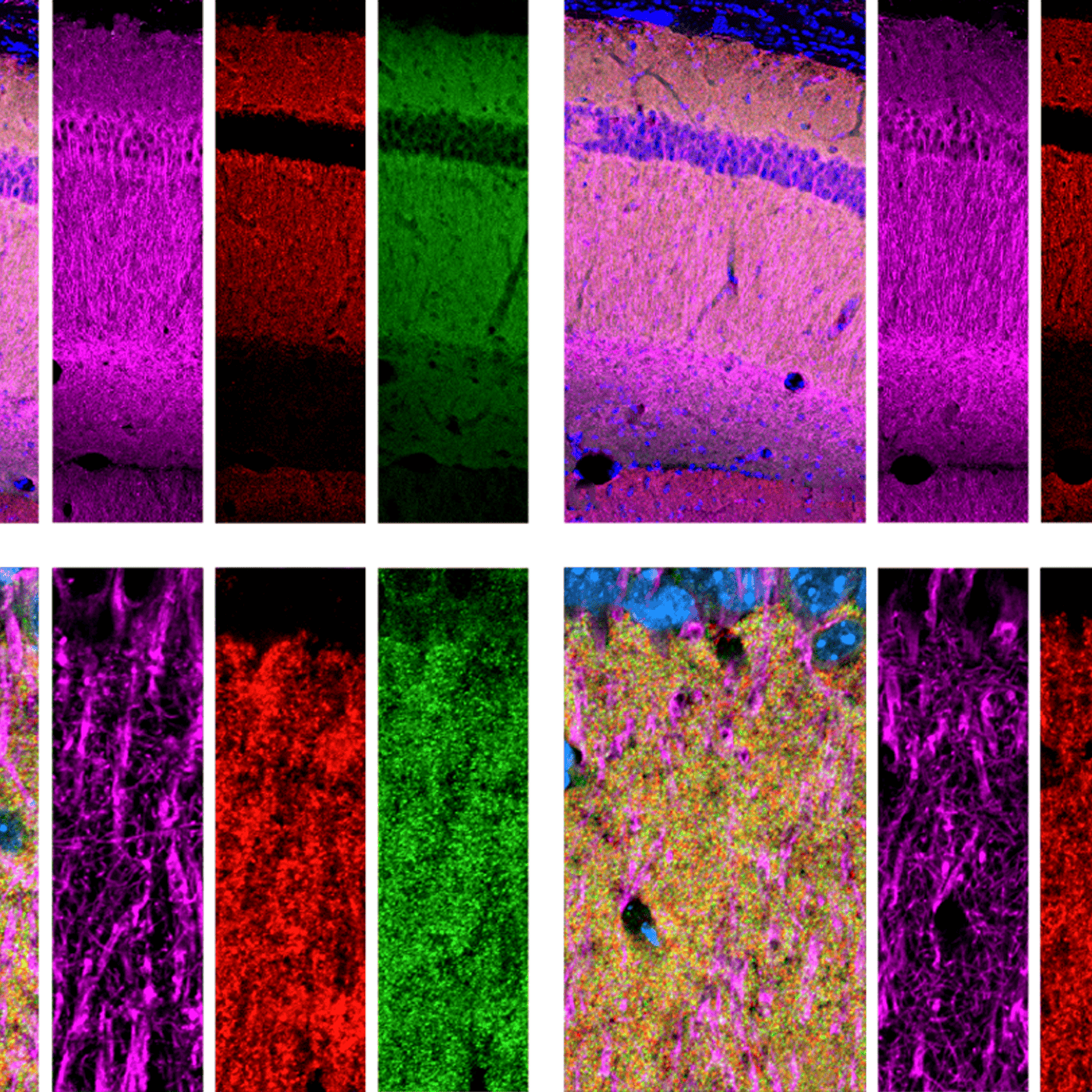 Dispute erupts over role of sticky proteins in astrocytes episode artwork