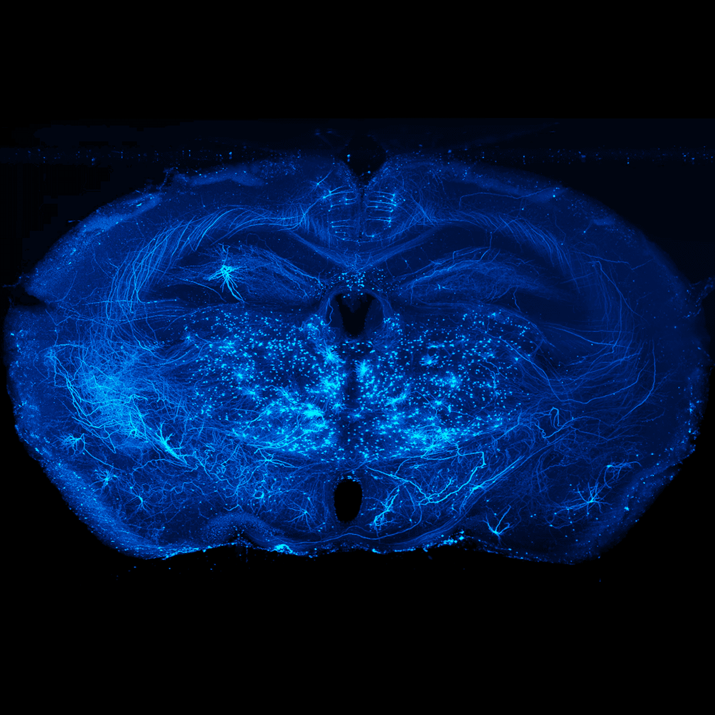 Repurposed electronics lens spies neurons across entire mouse brain episode artwork