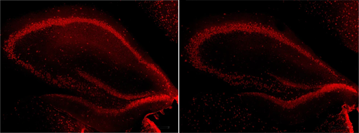 Research images of a mouse hippocampus.