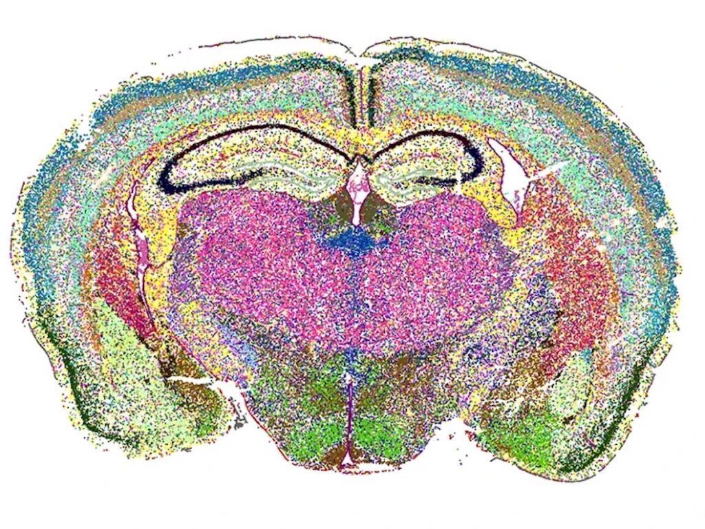 Research image of a mouse brain.