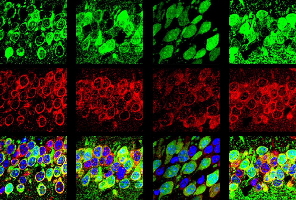 Research images of protein synthesis in mice.