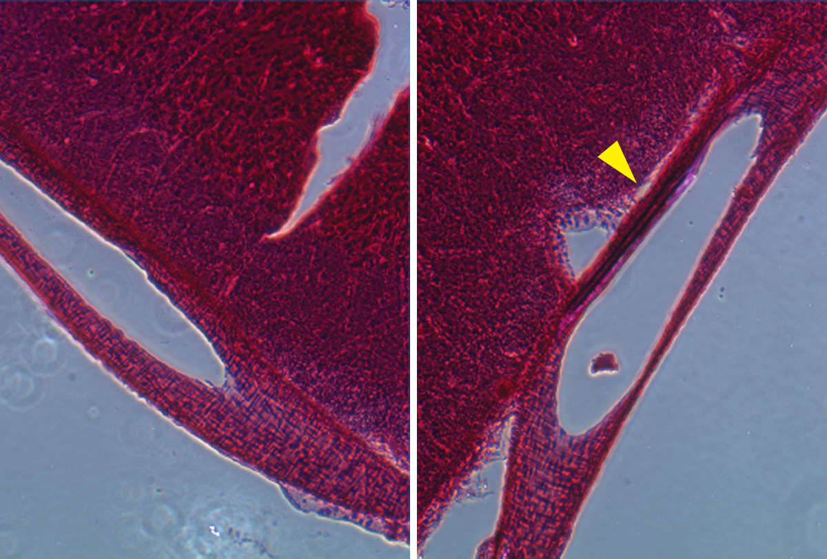 Close up of blood vessels shows probe sticking to vessel wall.