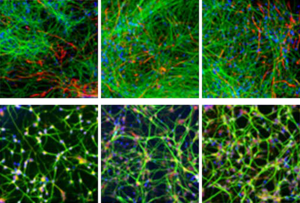 Research image of human cortical neurons grown from stem cells.