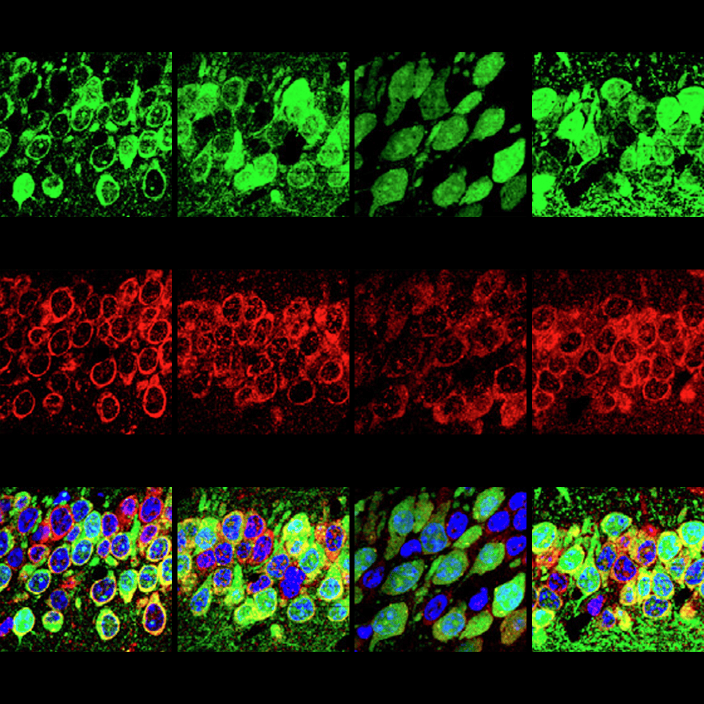 Neuronal deafness to stress may add to protein surplus in fragile X episode artwork