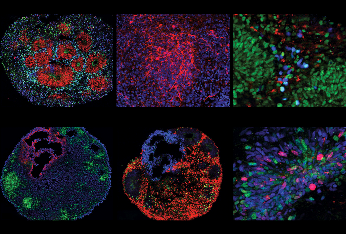 Research image of organoids in the forebrain.