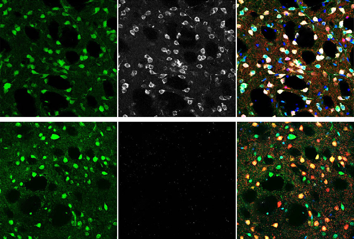 Research image of neurons in mice.