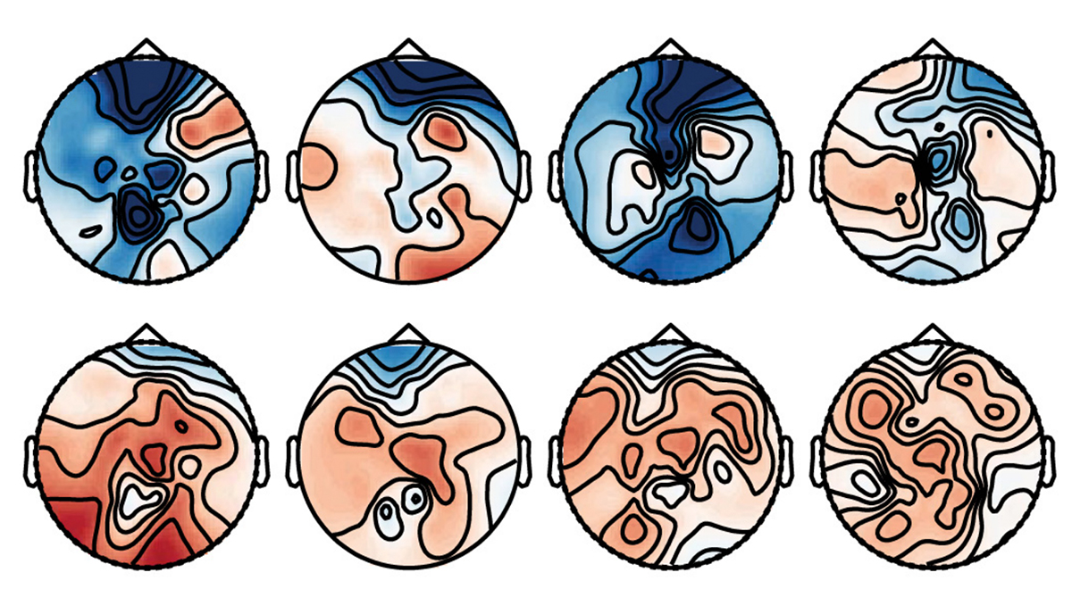 Research images of EEG results for autistic and non-autistic children