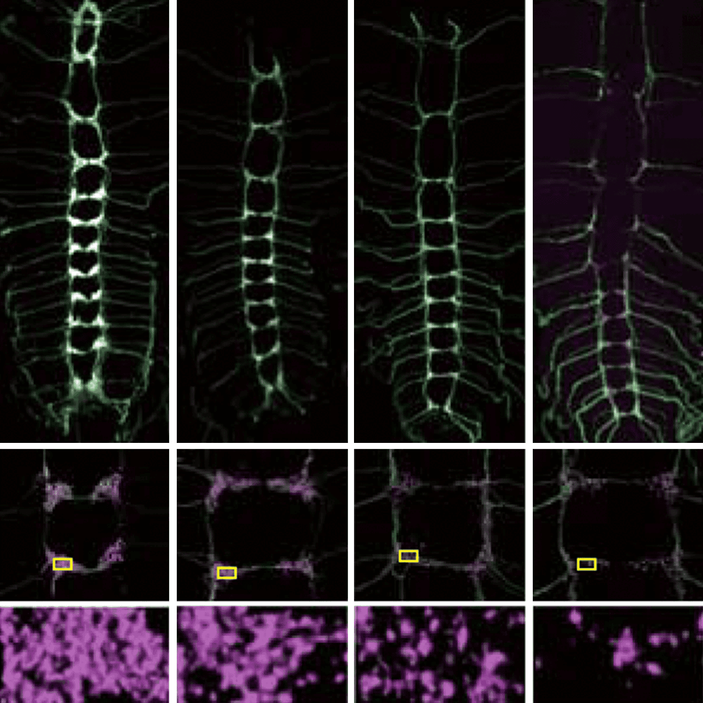 UBE3A's link to synaptic pruning bolstered by fly study episode artwork