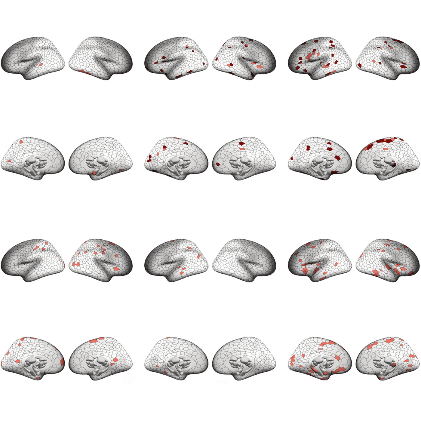 Alterations in circuits characterize six neuropsychiatric conditions episode artwork