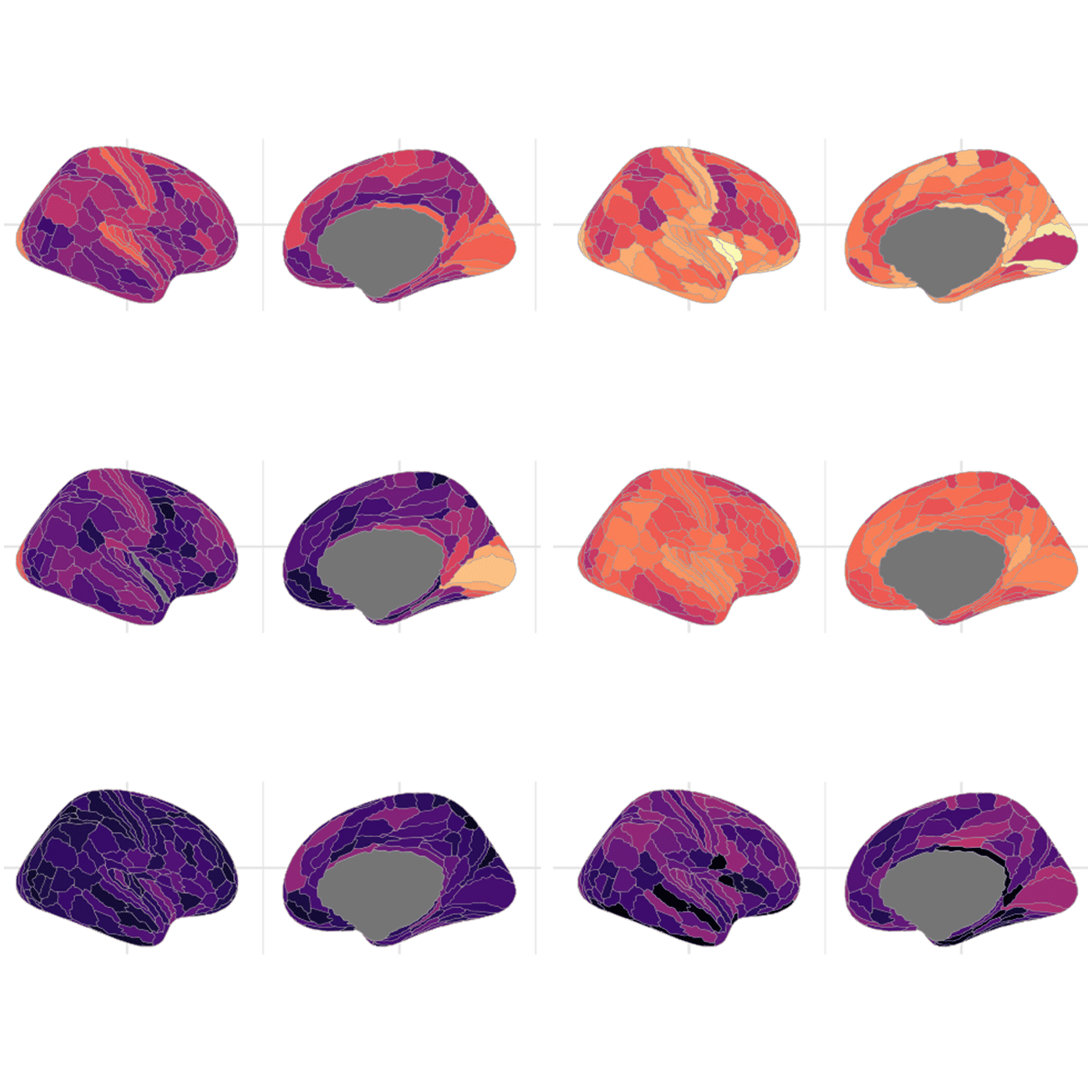 Common genetic variants shape the structure of the cortex episode artwork