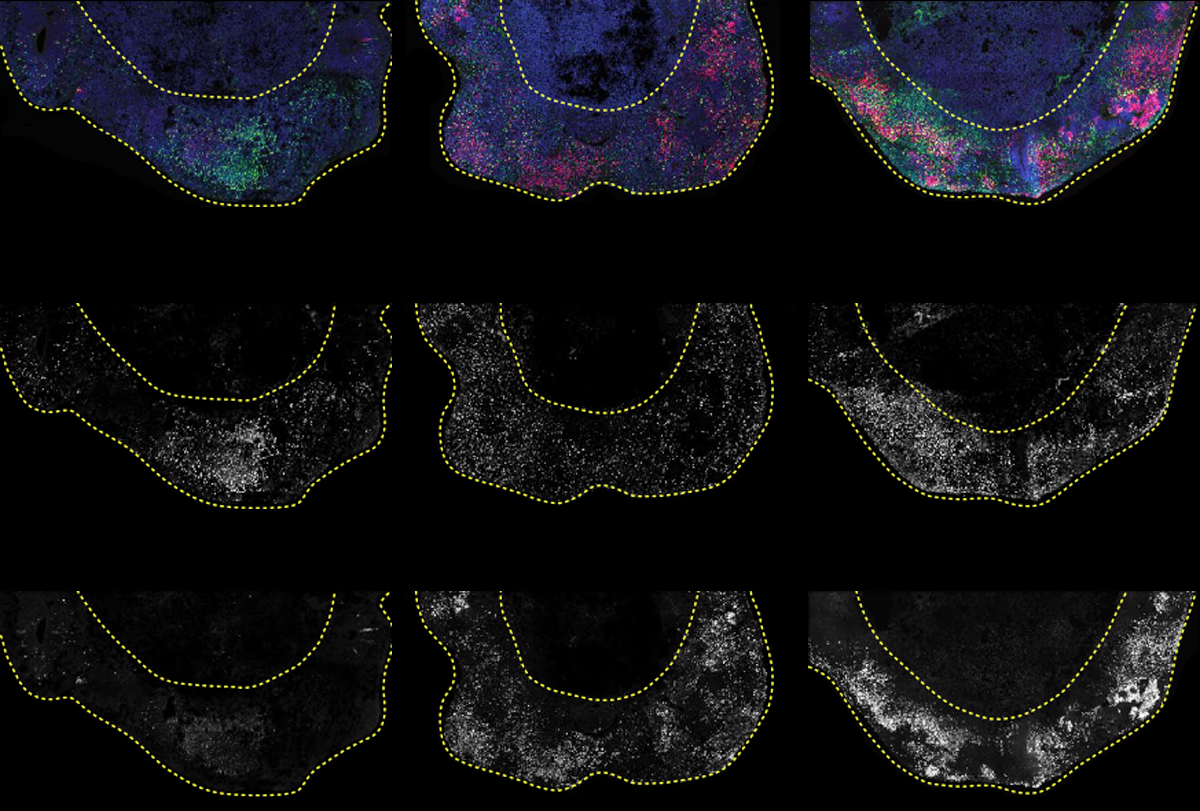 Research image of cerebral organoids.