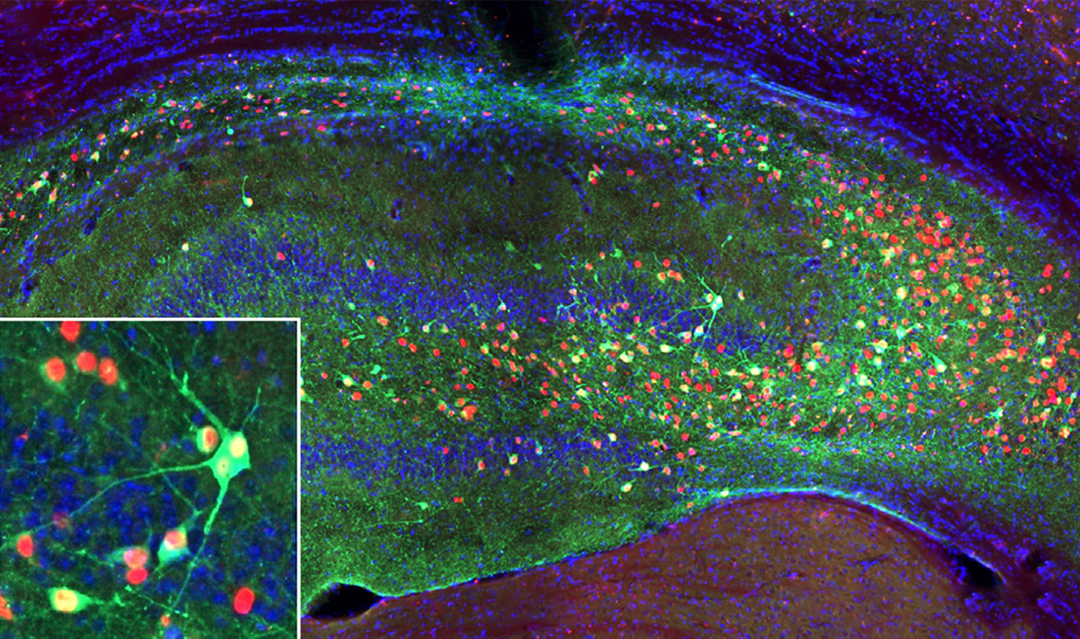 Research image of inhibitory cells migrating through a mouse’s hippocampus after being transplanted.