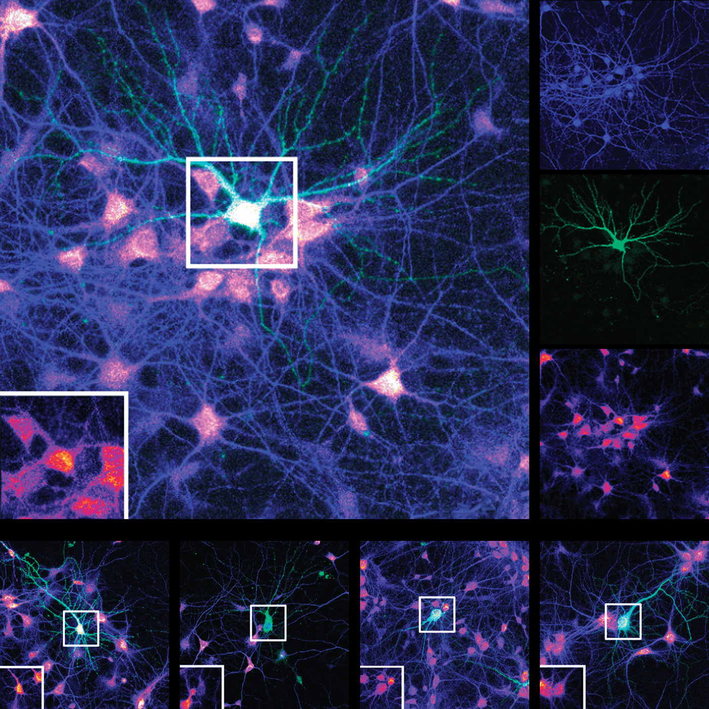 Mutations in multipurpose gene deal dendrites a double whammy episode artwork