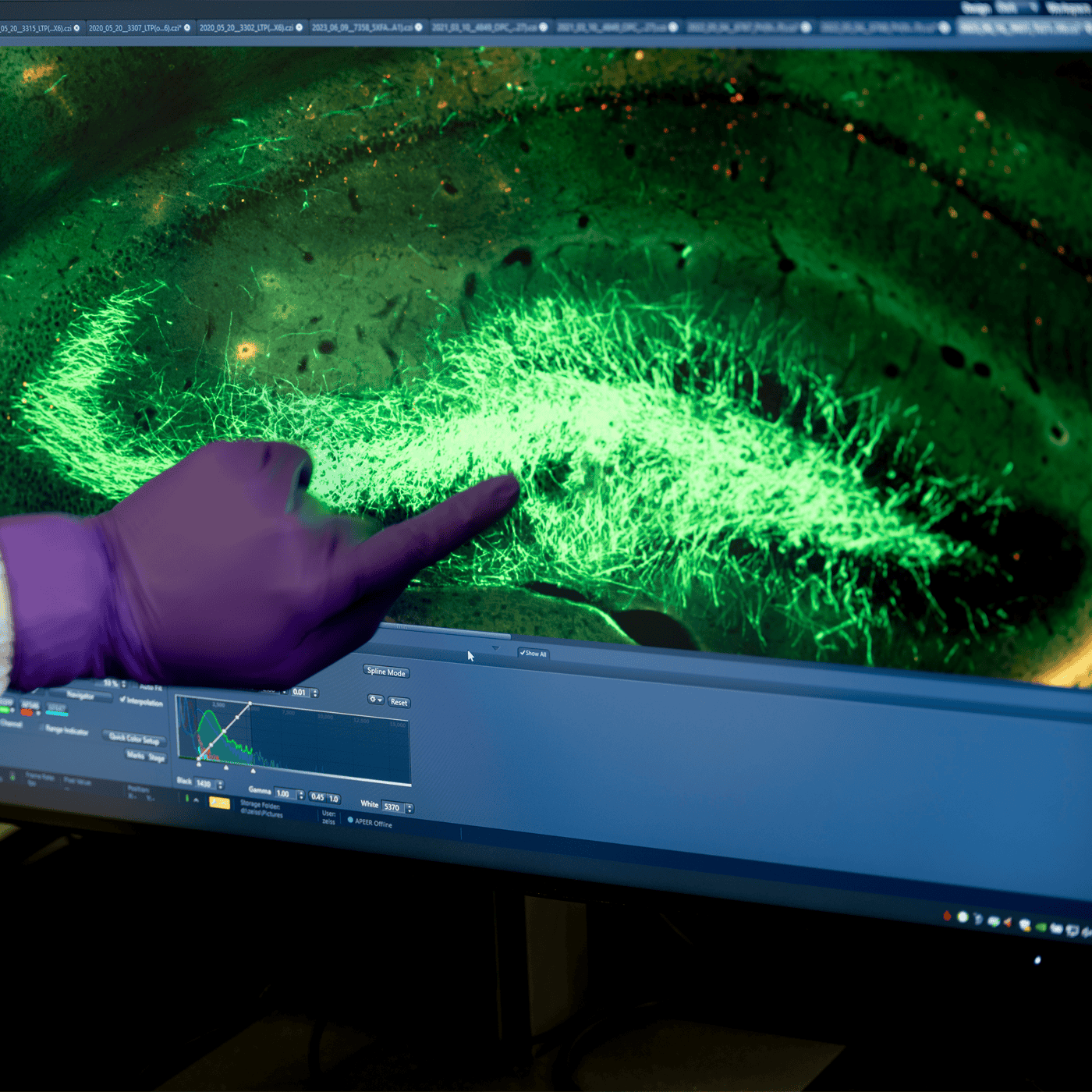 Uncertainty and excitement surround one company's cell therapy for epilepsy episode artwork