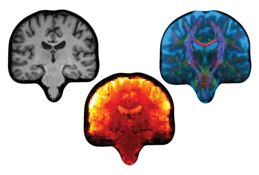 Images from structural, functional and diffusion MRI scans.