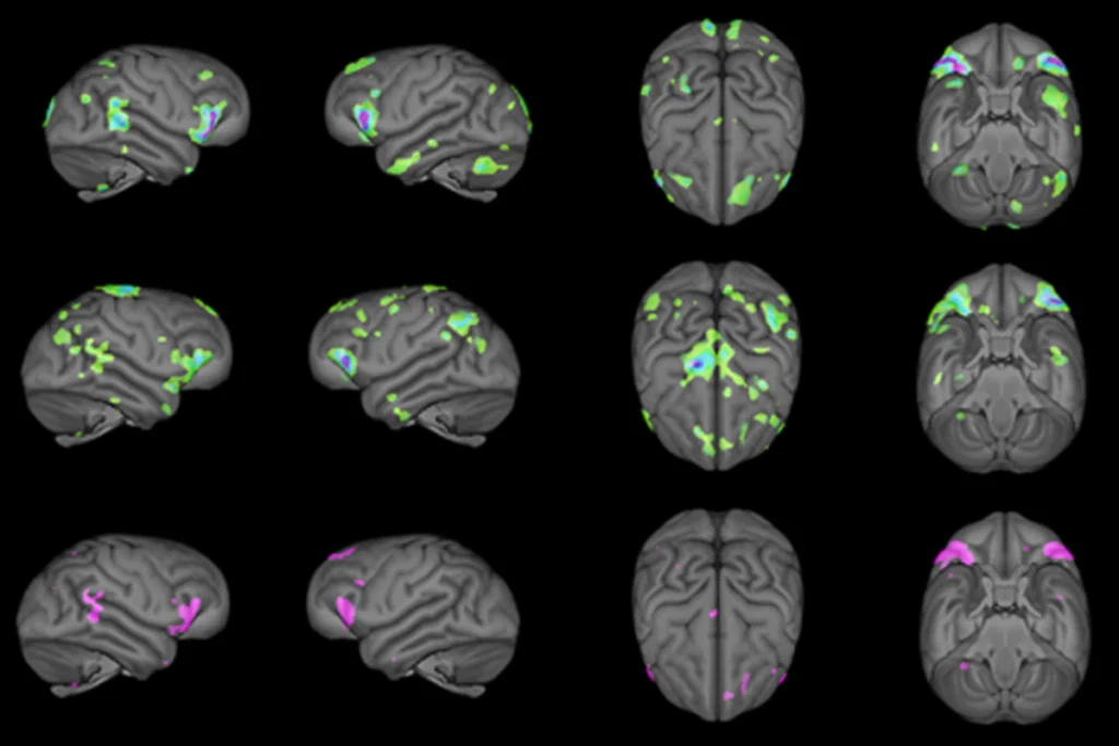 A research image of gray matter in chimpanzees.