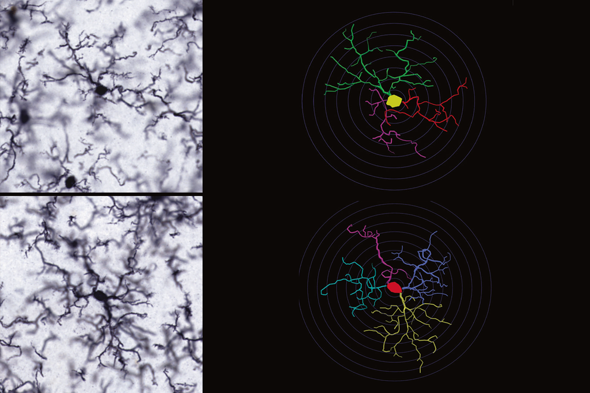 Research image of microglia in rats.