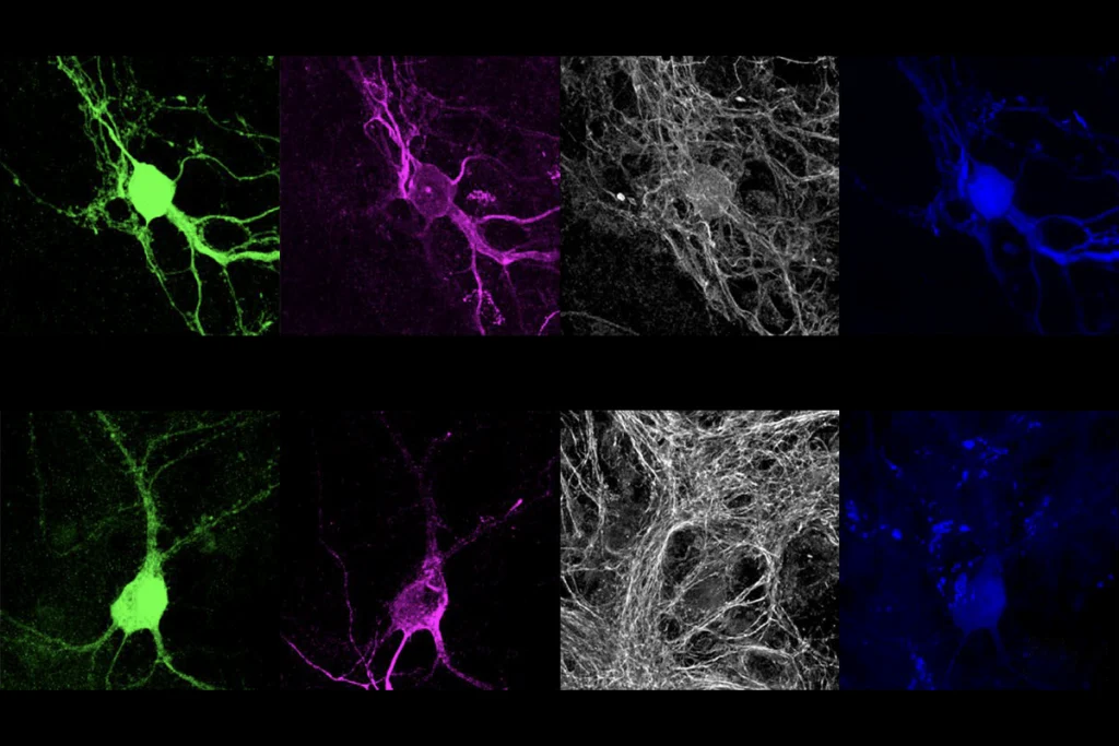 A research image of neuronal dendrites in mice.