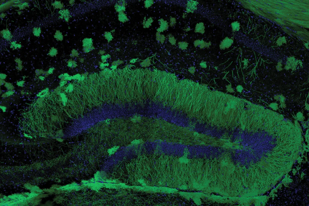A research image of a mouse brain