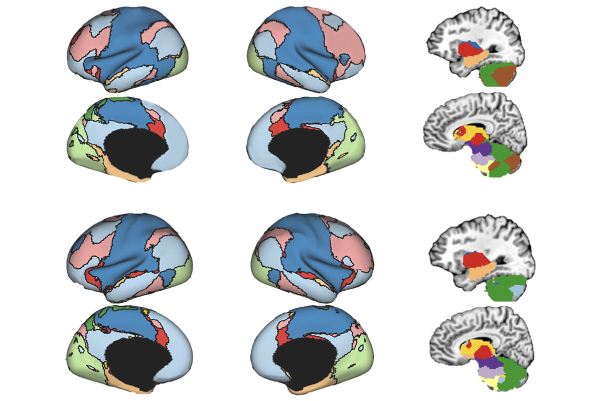 Whole-brain images shaded in different colors to highlight functional networks.