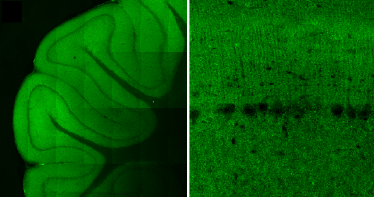 Two side-by-side slices of cerebellum, from different perspectives.