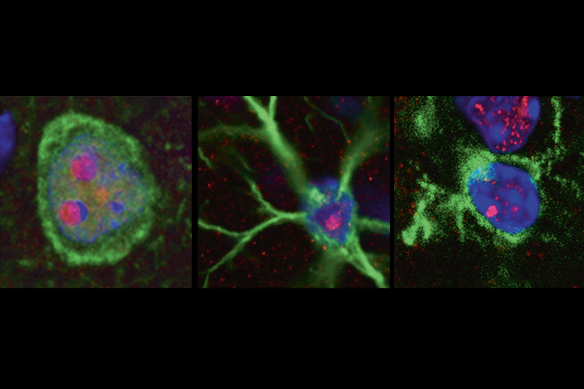 Research image of gene expression in neurons, astrocytes and microglia.