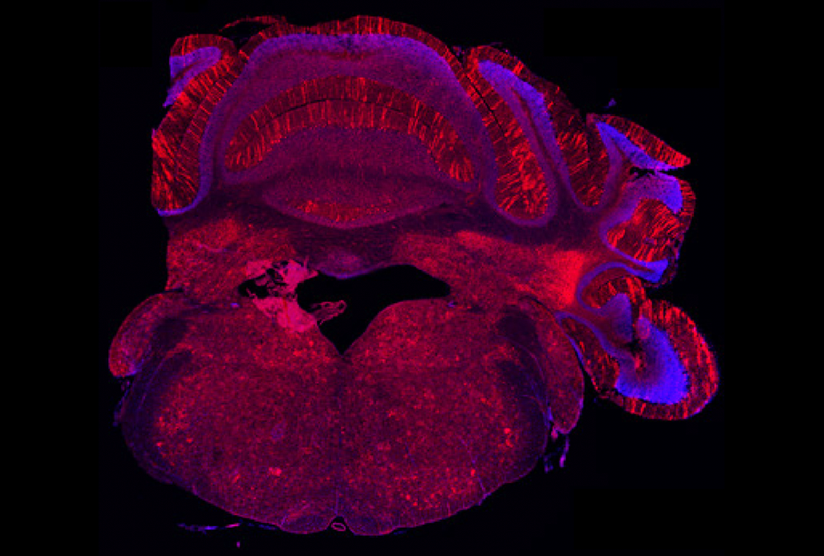 A slice of a cerebellum.