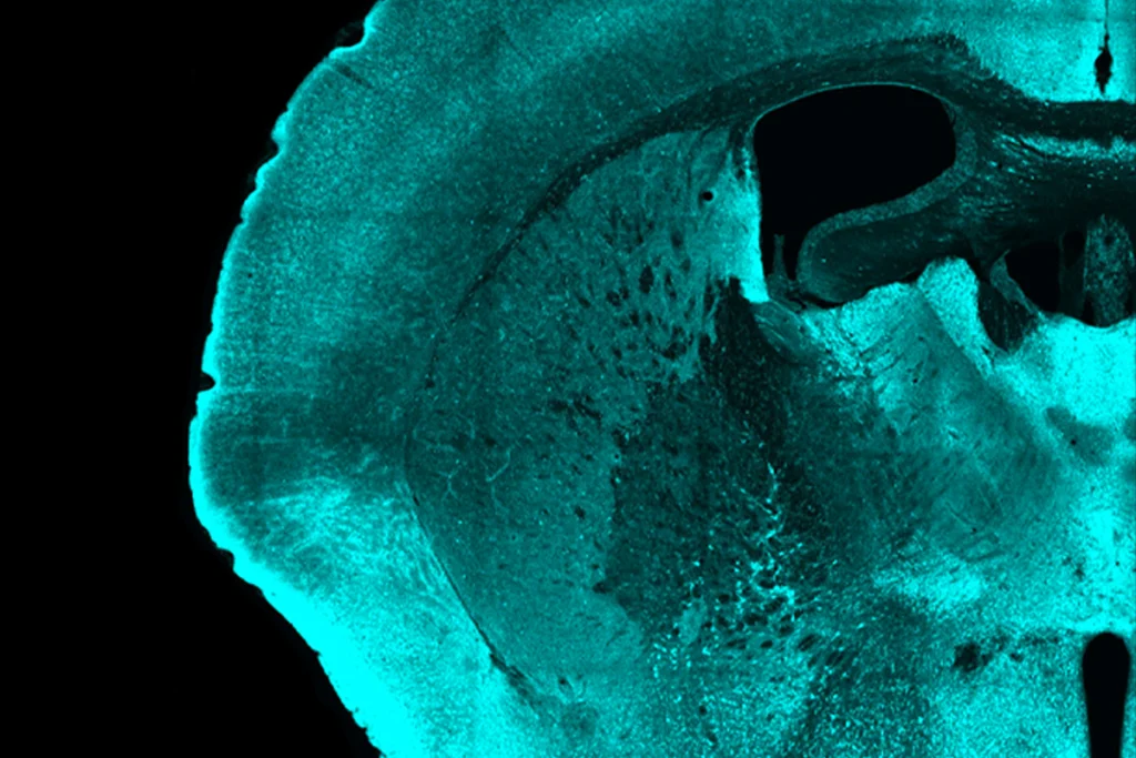 A research image of a mouse brain under anesthesia