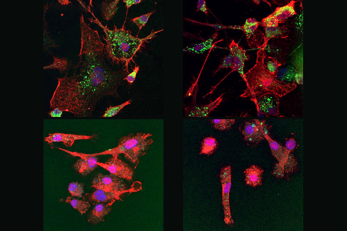 Research image of microglia.