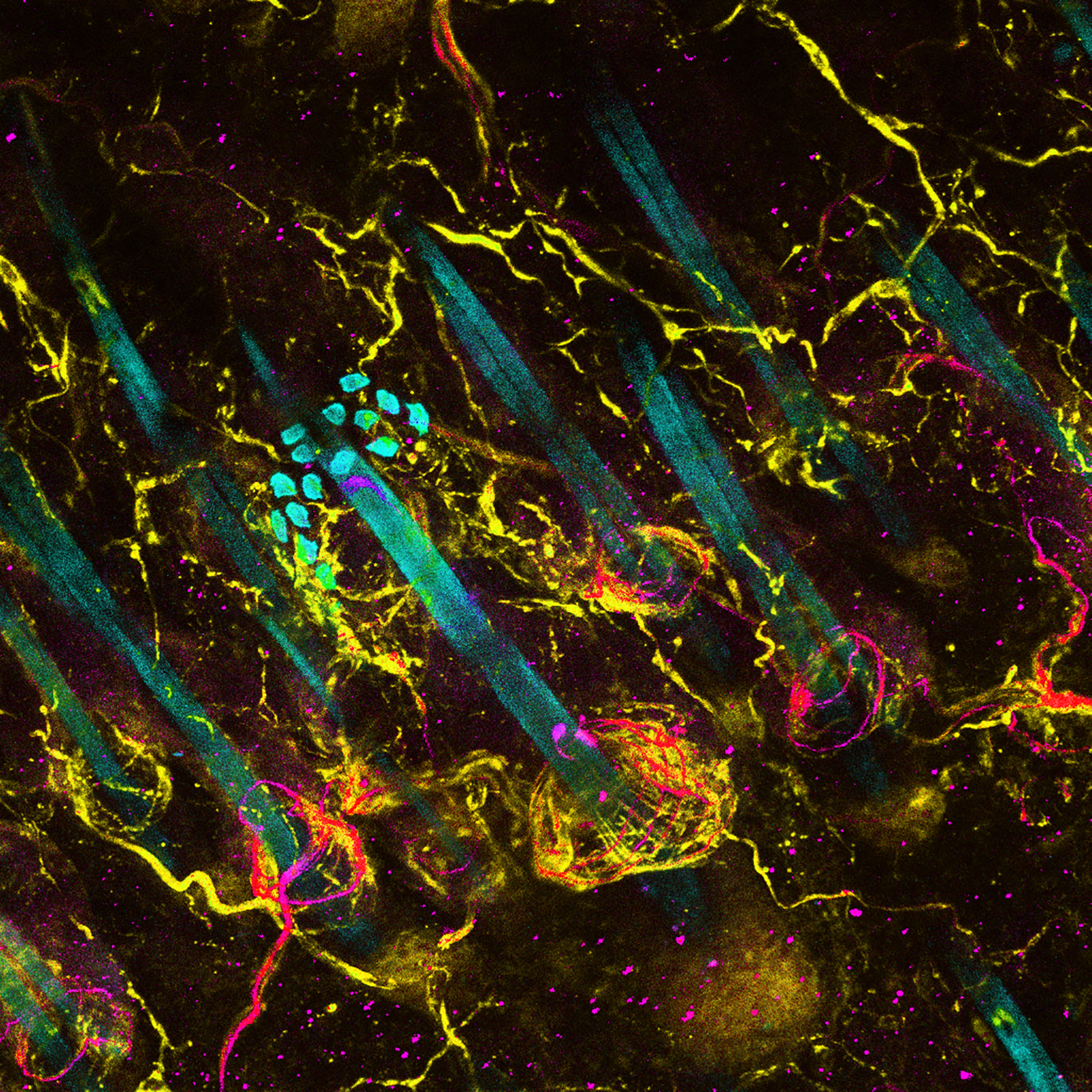 Research image of sensory neuron endings wrapping around hair follicles in a mouse’s skin.