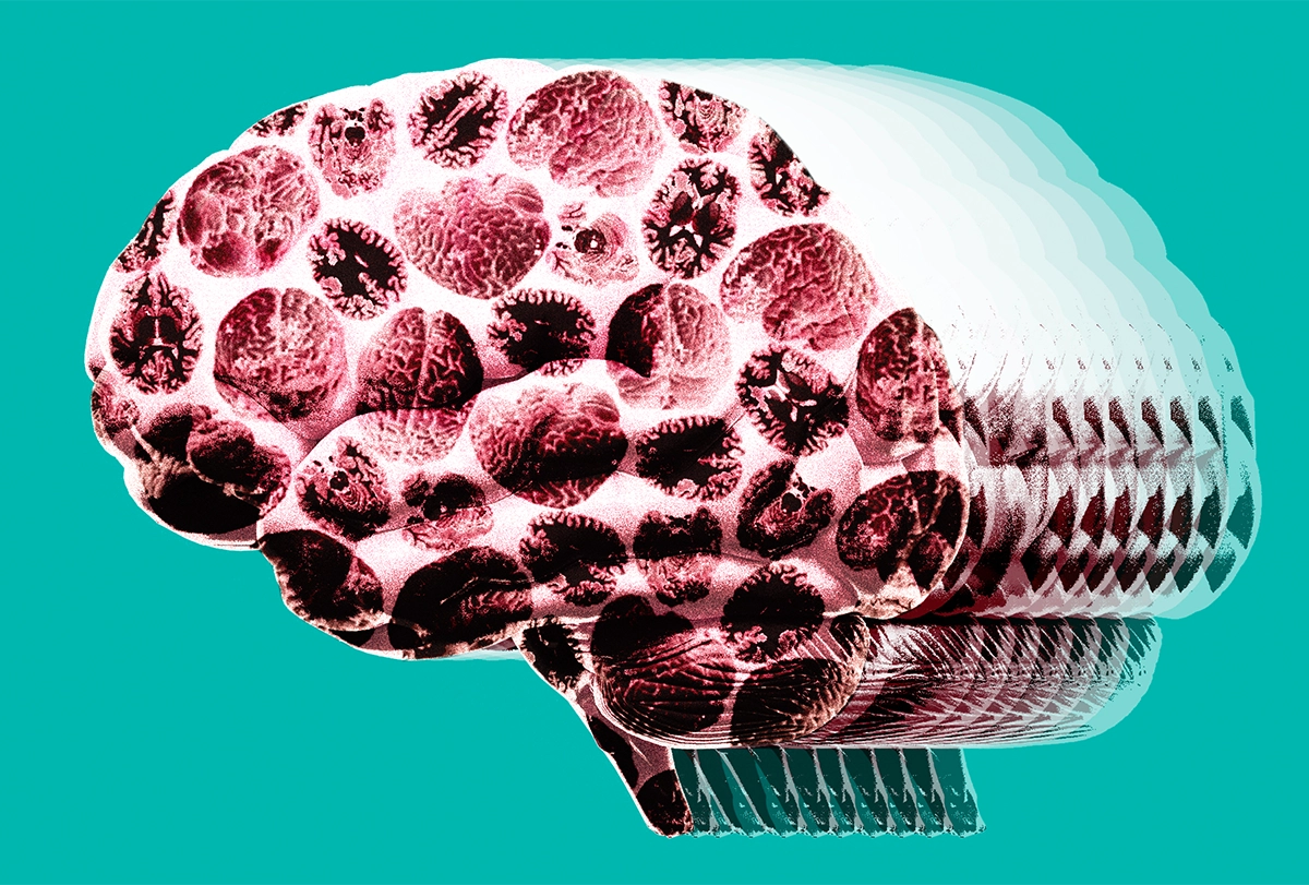 Illustration of a brain made up of many smaller brains.