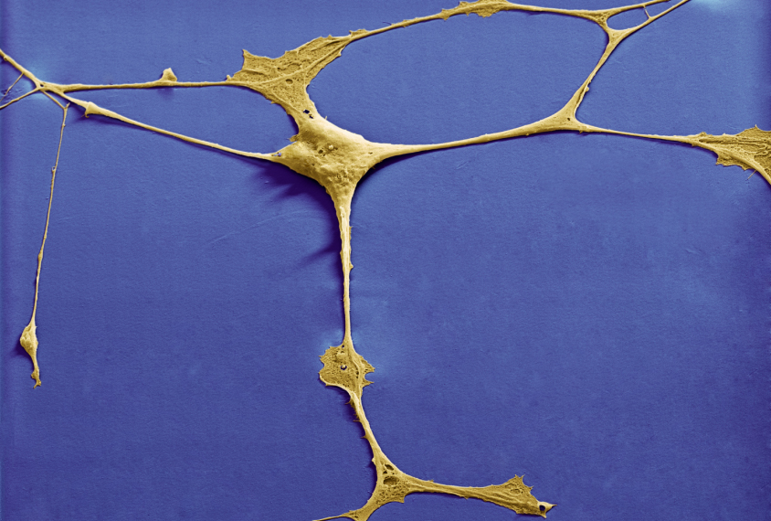 Neural progenitor cells in a culture medium, color-enhanced scanning electron micrograph (SEM).