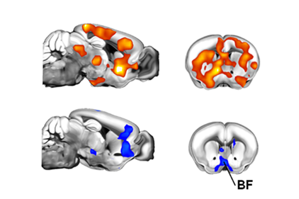 Research image of brain activity