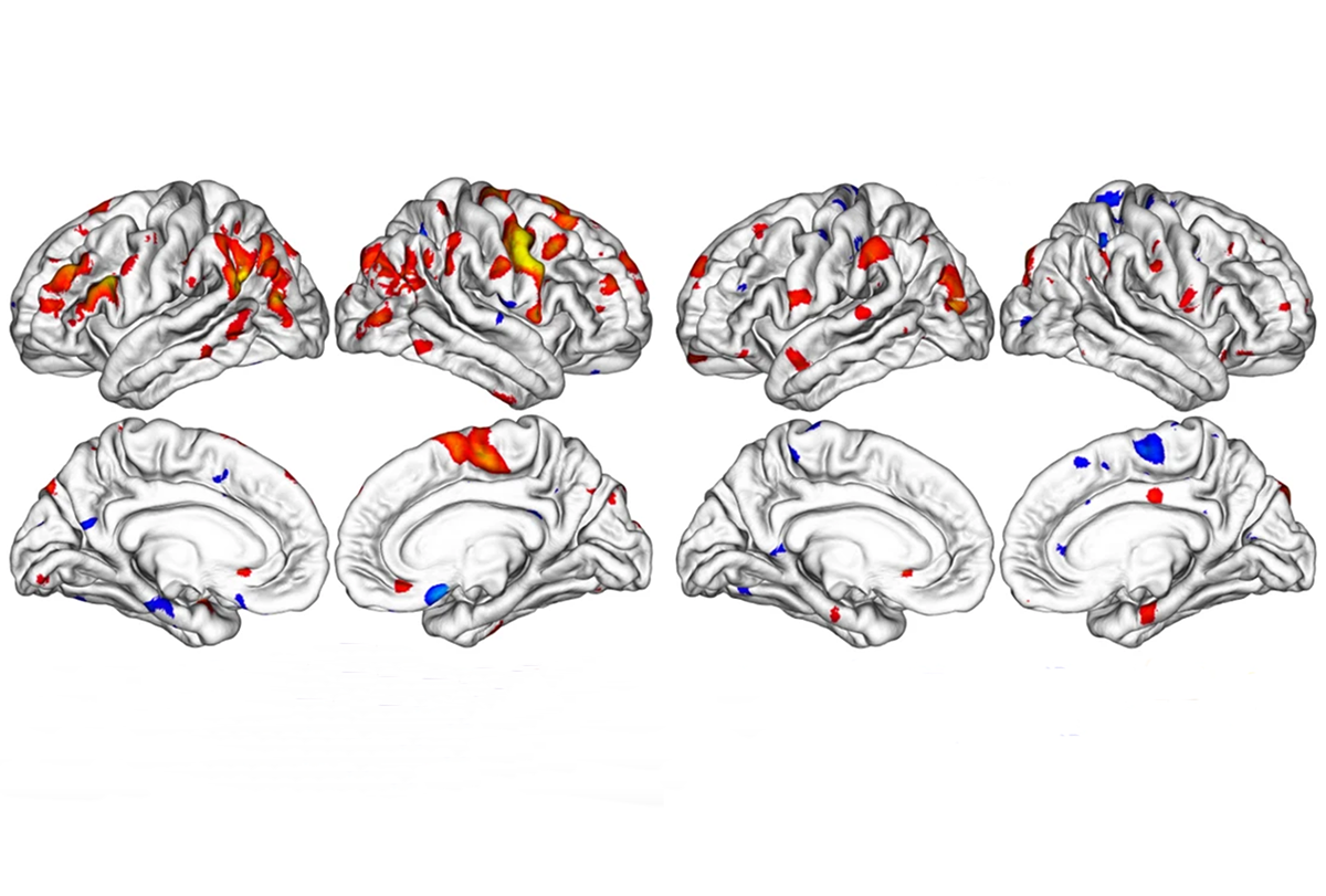 A research image of brain scans