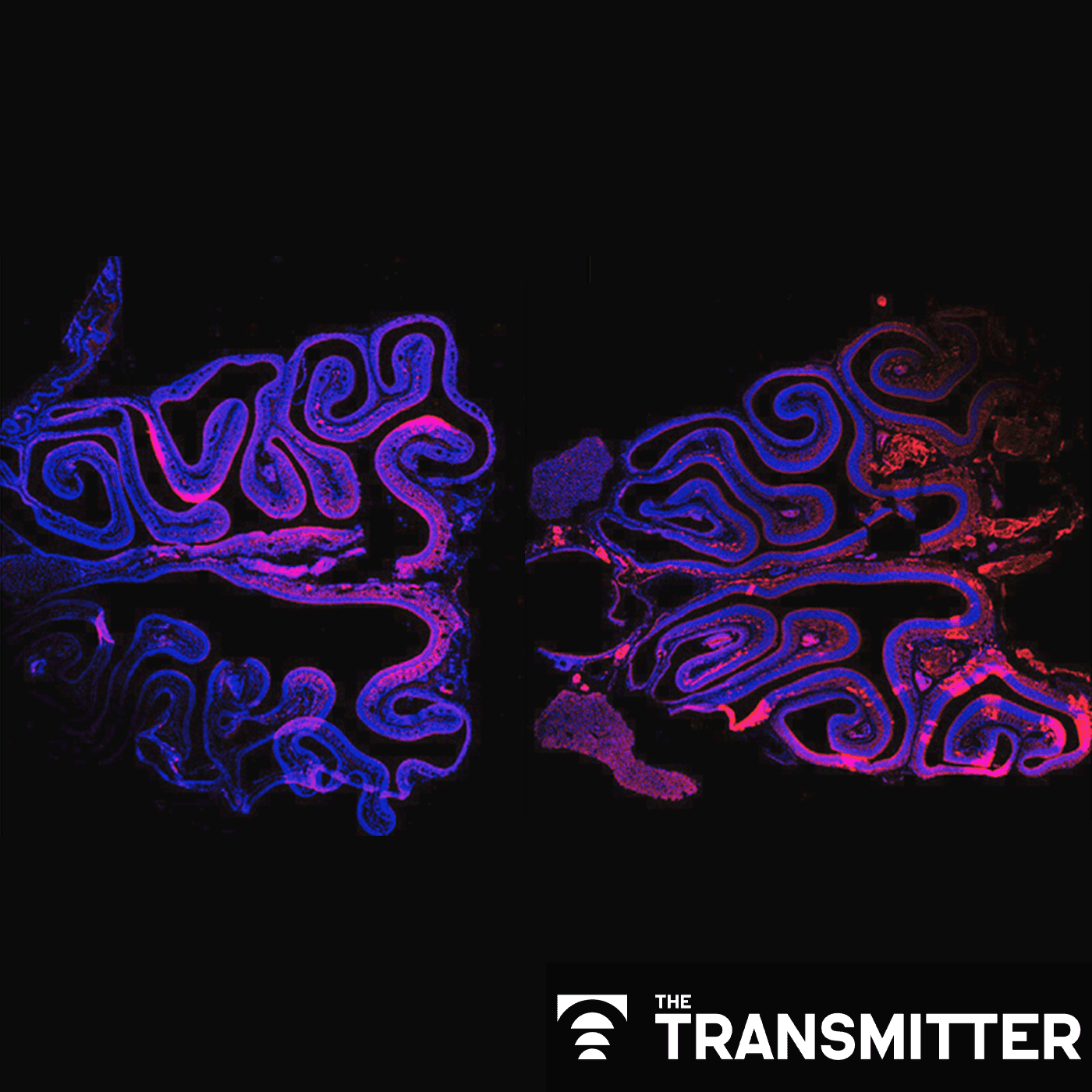 Is it time to worry about brain chimeras? episode artwork