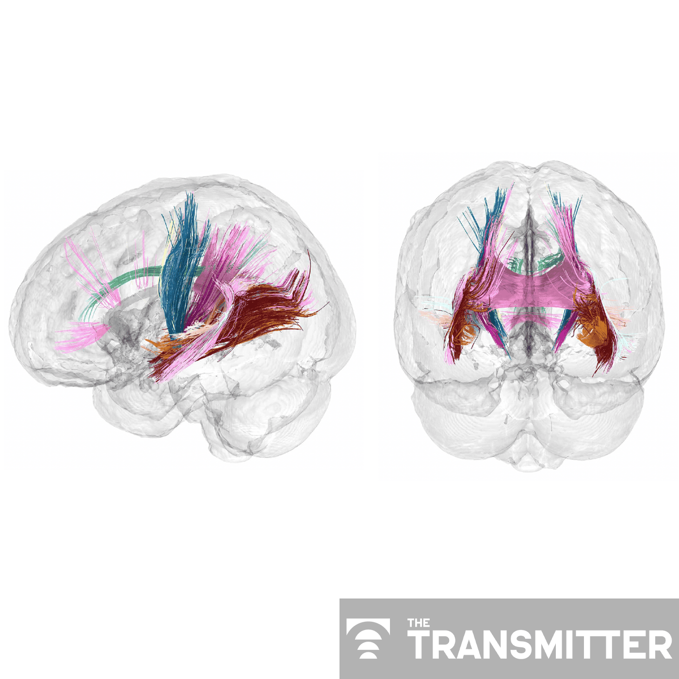 Repeat scans reveal brain changes that precede childbirth episode artwork
