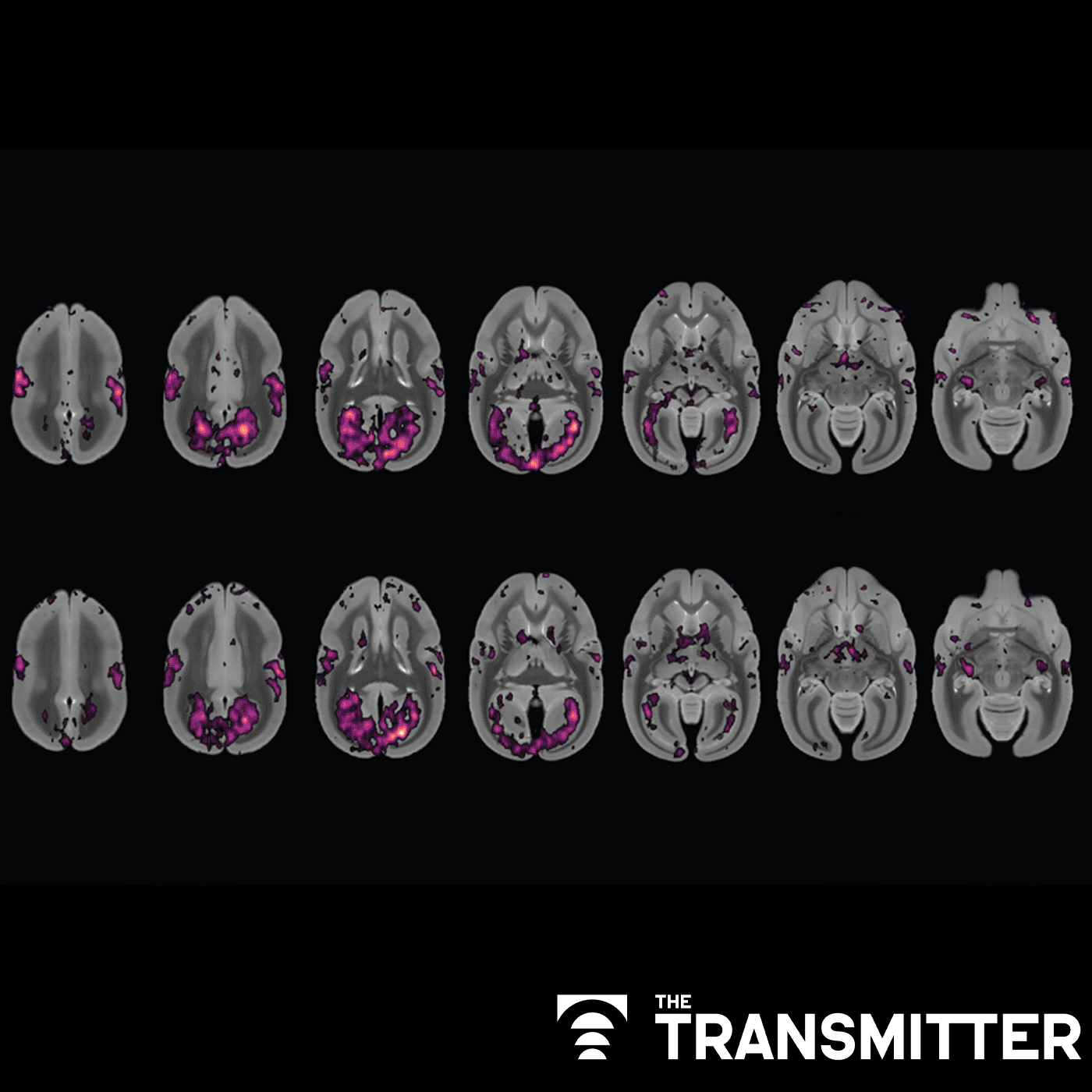 Timing tweak turns trashed fMRI scans into treasure episode artwork