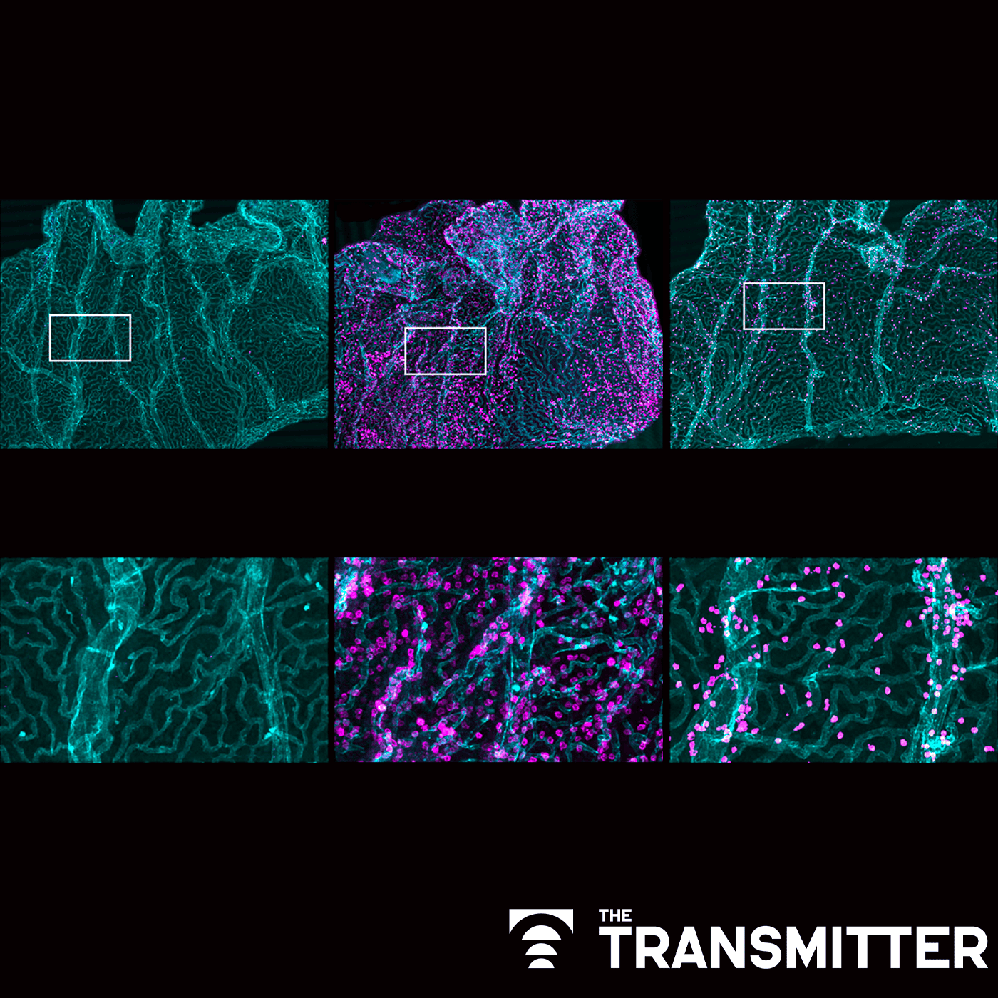 Immune cell interlopers breach-and repair-brain barrier in mice episode artwork
