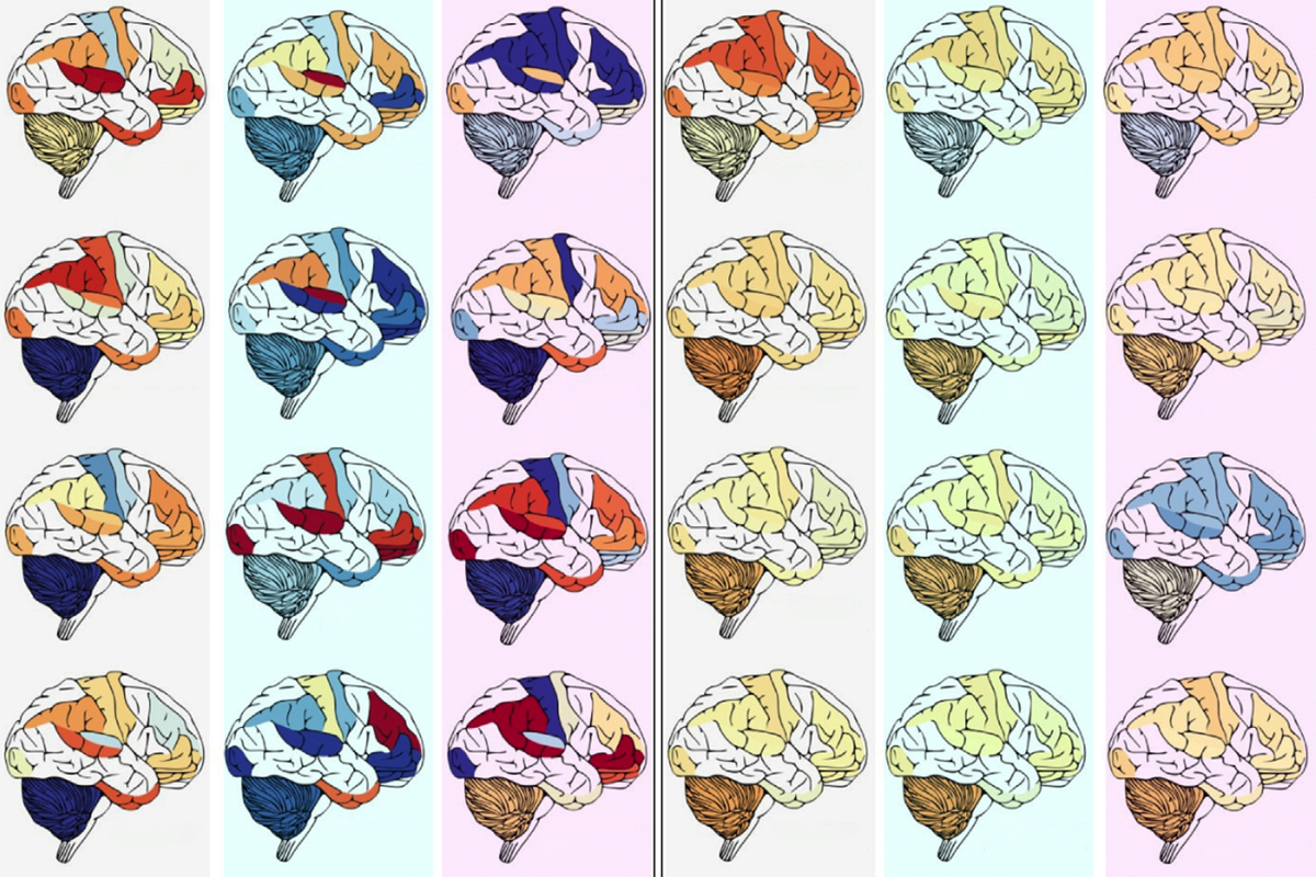 Research image highlighting different brain regions.