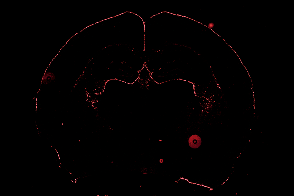 Astrocytes in a mouse brain.