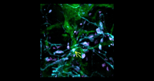 Video catches microglia in the act of synaptic pruning | The ...