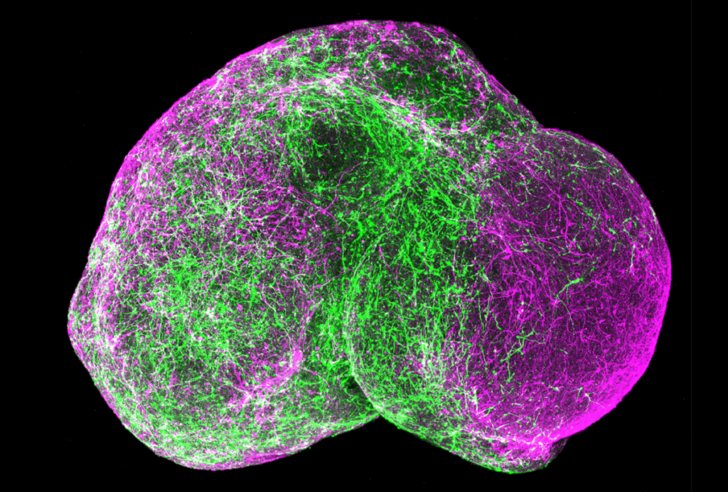 Research image of an assembloid.