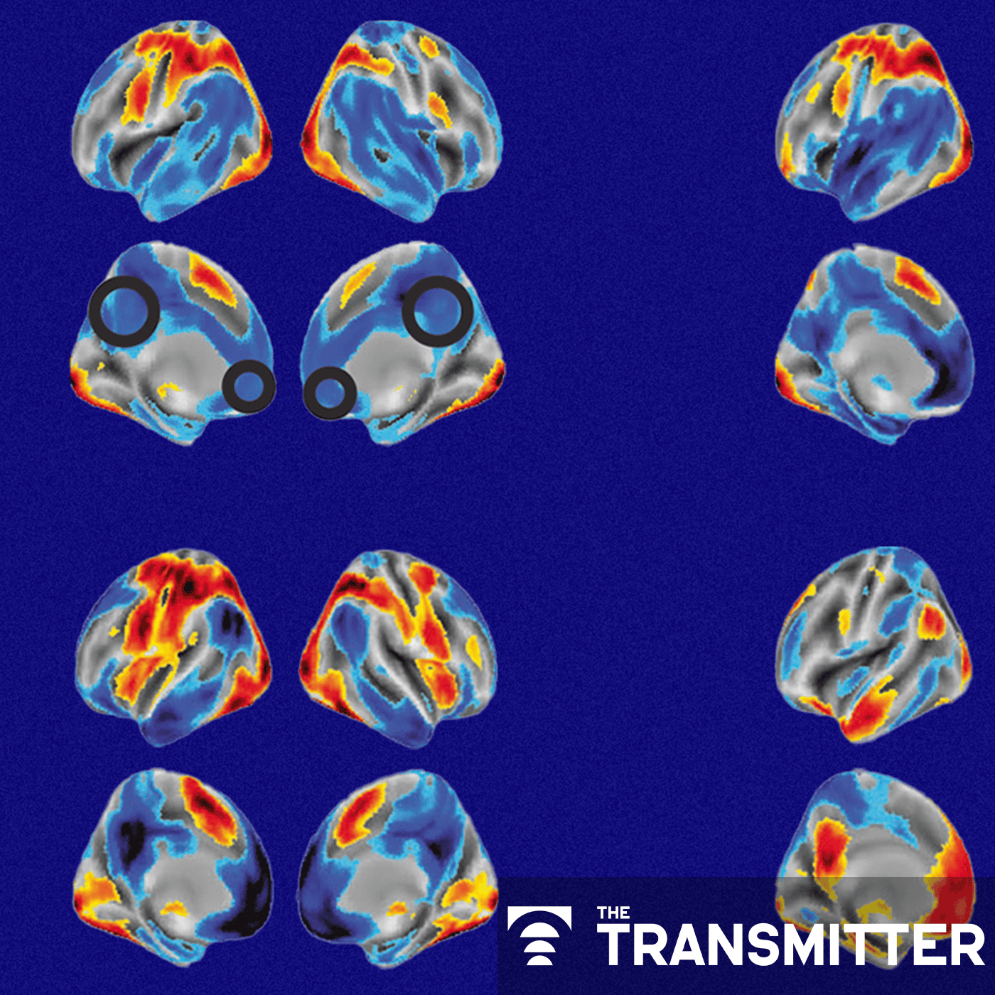 During decision-making, brain shows multiple distinct subtypes of activity episode artwork