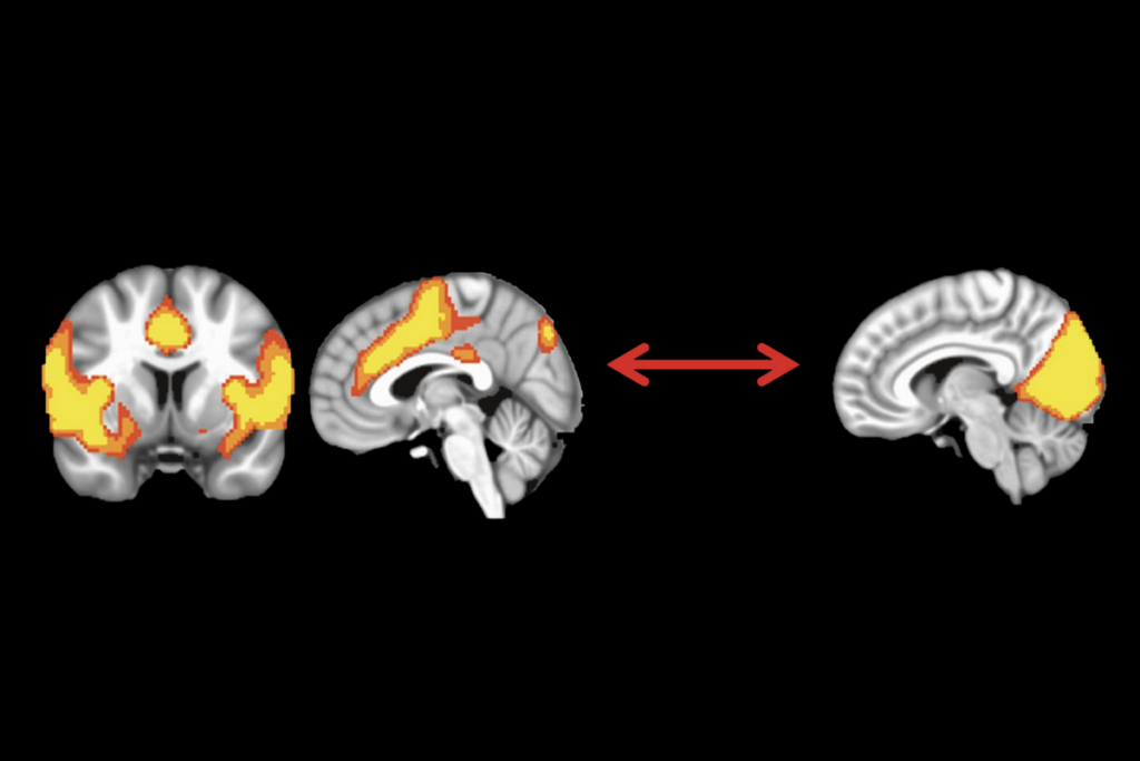 Research image of resting-state functional activity in a human brain.