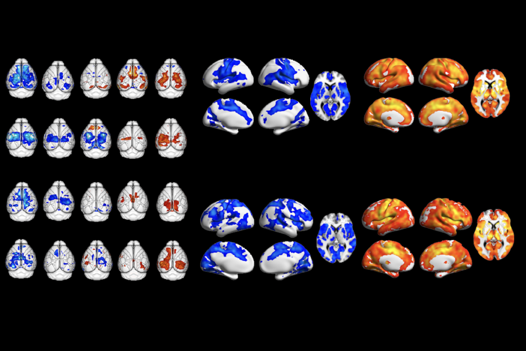 Research image of grids of mouse and human brain scans.